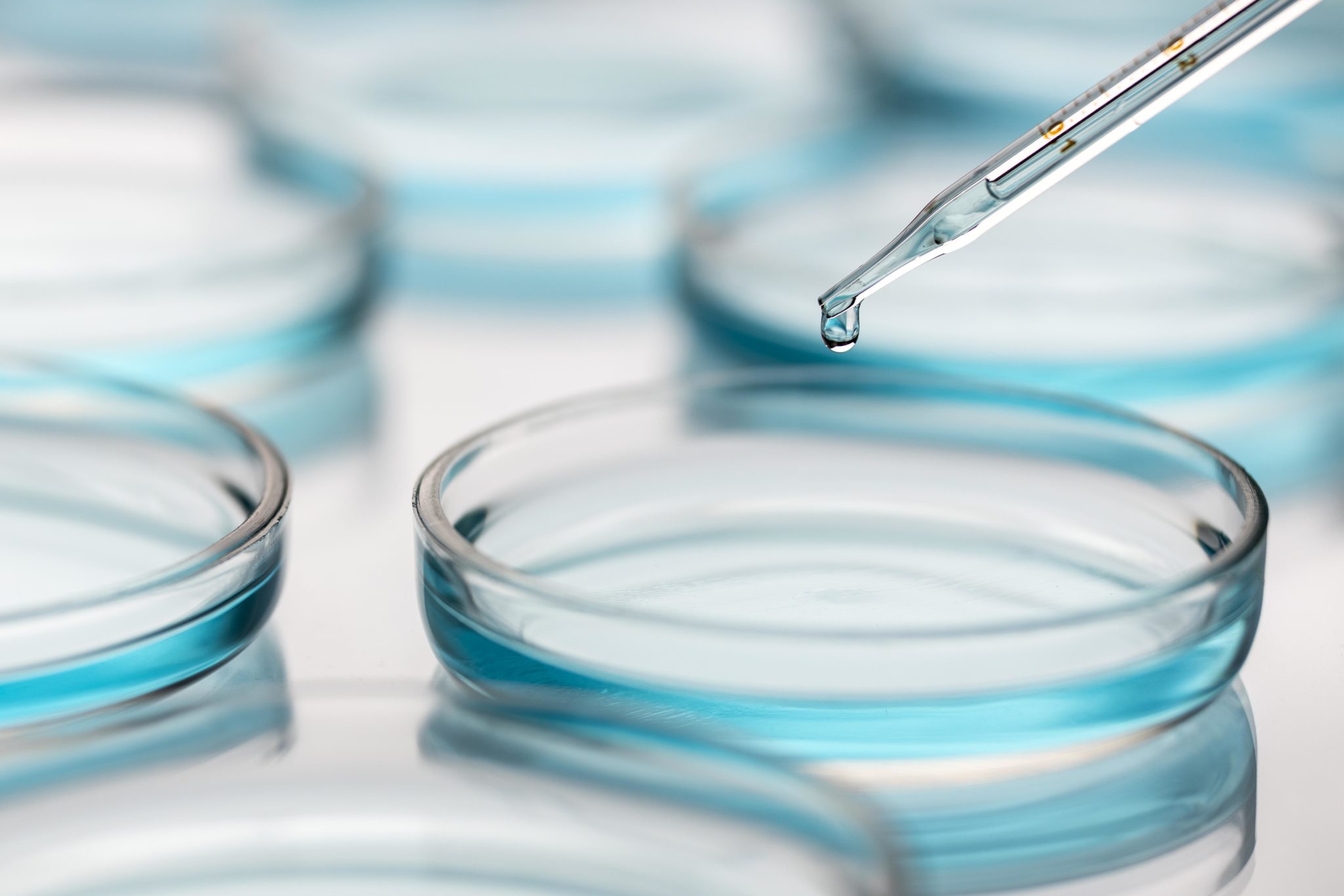 Petri dishes in medical lab with dropper